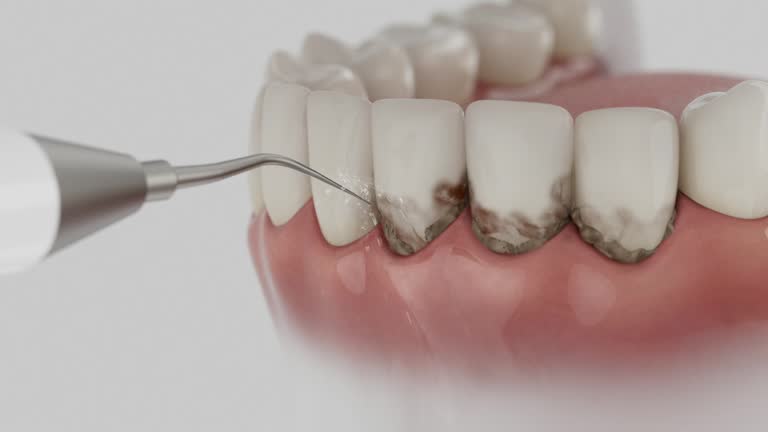 Trusted Root Canal Treatment service in Yale, MI - Dentist Open Now